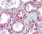 PTCH1 antibody - C-terminal region